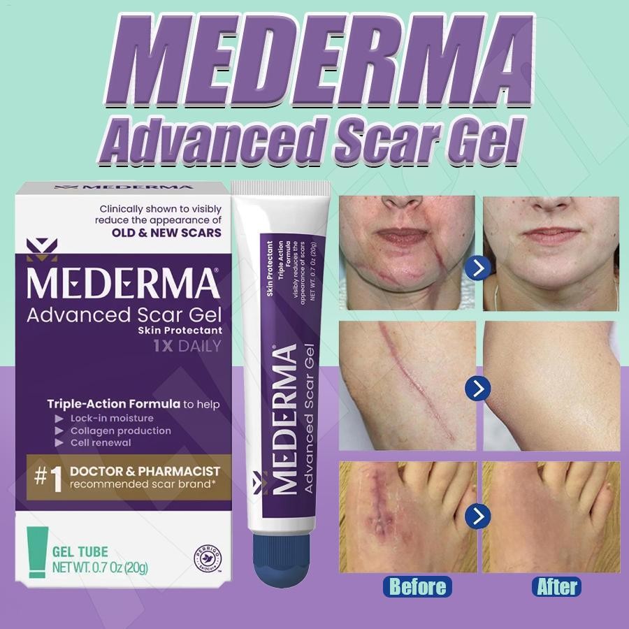 Mederma Advanced Scar Gel ผิวปกป้องลดลักษณะของเก่าและรอยแผลเป็นใหม่ Long-Term Scar Care cupionph