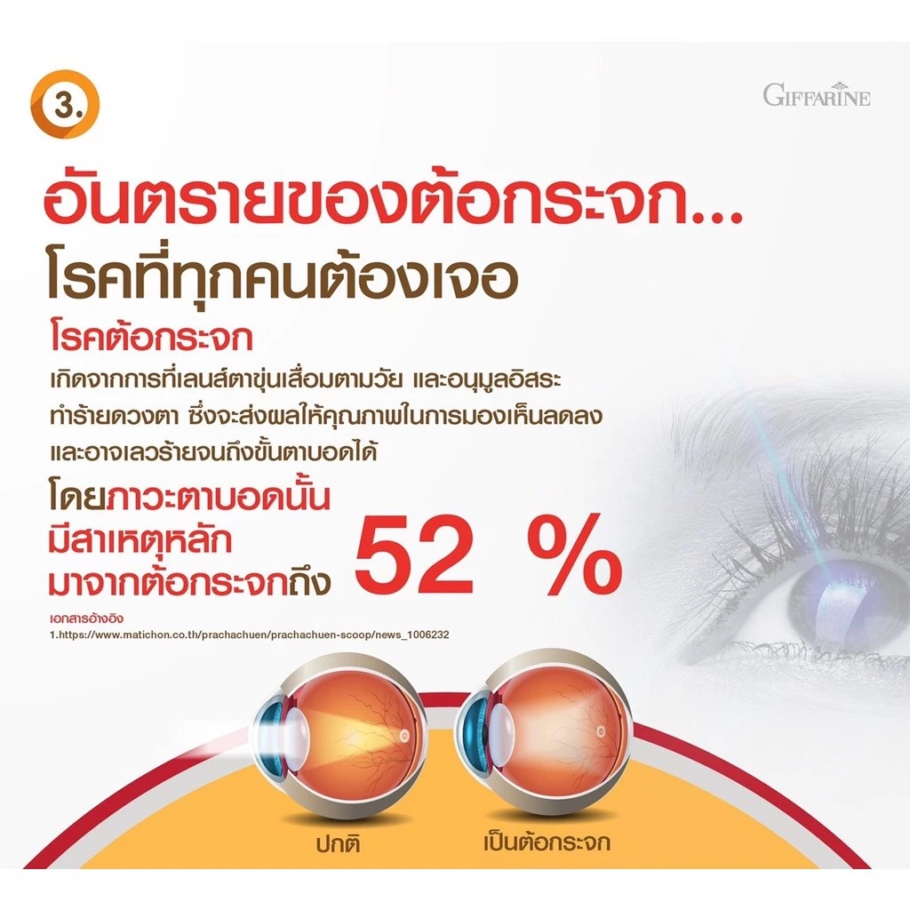 วิตามินบำรุงสายตา แอลซีวิต พลัส กิฟฟารีน LZ Vit Plus Giffarine ลูทีน ซีแซนทีน วิตามินเอ ดูแลดวงตา thumbnail 6