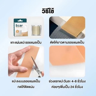 แผ่นปกปิดรอยแผลเป็น สติกเกอร์คอนซีลเลอร์ รักษารอยแผลเป็น กันน้ำและระบายอากาศได้ ฉีกและติดง่าย ส่วนผสมอ่อนโยนและปลอดภัย