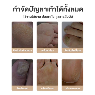 เครื่องขัดเท้าไฟฟ้า เครื่องขัดส้นเท้าแตก 2 หัวขัดปรับระดับ ถอดออกและซักได้ ดูแลผิวหนังที่ตายแล้วและหนังด้าน