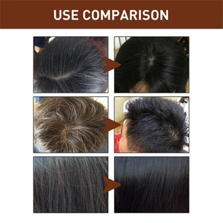 [ซื้อ 1 แถม 1]สบู่โพลีโกนัม สบู่รากโสมดำ สบู่สระผมรากโสมดำ ผมหนาดกดำ ผมชุ่มชื้น ยาสระผม
