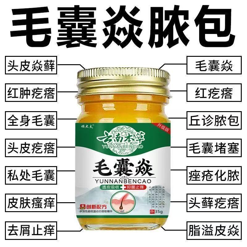 Yunnnan สูตรผม Foliculitis เฉพาะครีมหัว Face Back สิว Pseudo-Acne Pseudo-Acne Pseu