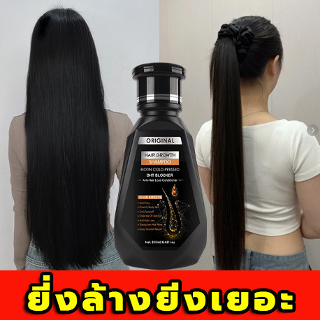แชมพู DHT Shampoo สูตรขิง นำเข้าจากอเมริกา แชมพูลดผมร่วง ดูแลเส้นผม 250ml  เหมาะสำหรับผมบาง ผมร่วง ผ
