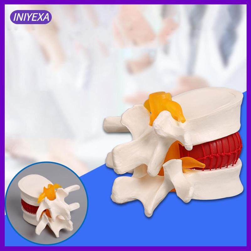 [Iniyexa] Human Disc Herniation Model Spine Model Tool โมเดลกระดูกสันหลังสําหรับนักเรียนการสอน
