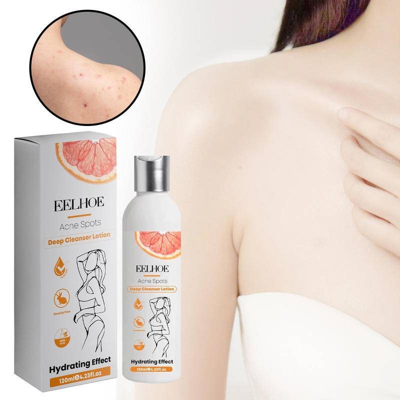 Eelhoe Body Care Cream ลด Black Buckthorn Skin Acne Moisturizing Whitening Skin Body Cream