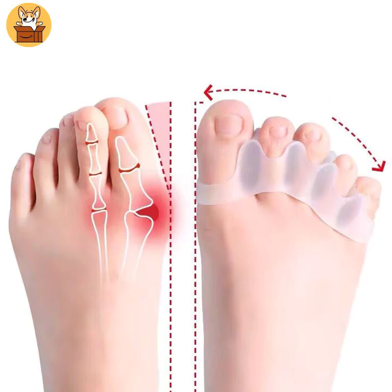 Am-az2Pc ซิลิโคน Toe Separator นิ้วฟุต Toe Spreader Hallux Valgus Bunion Corrector Toe Straightener Corrector Finger Separators