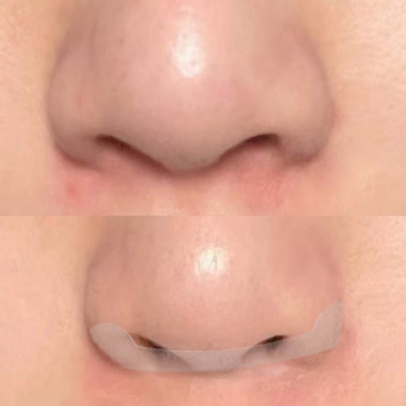 แผ่นแปะจมูกที่มองไม่เห็น 60 ชิ้น – Adhesion กันน้ําและกันเหงื่อ, การออกแบบระบายอากาศโปร่งใสสําหรับใช้ทุกวัน/กีฬา, สารละลายสร้างจมูกทันที ราคา ถูกที่สุด ดีลบีเคเค แกลเลอรีภาพที่ 5