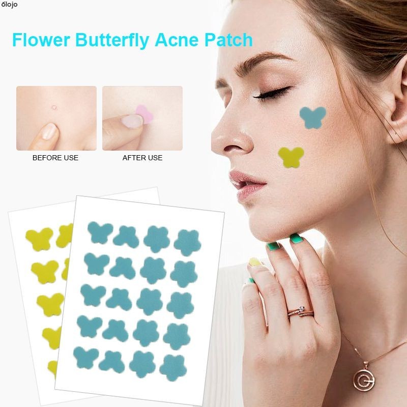 แผ่นแปะสิว รูปหัวใจ ดาว น่ารัก สีสันสดใส สําหรับติดตกแต่งสิว -oo