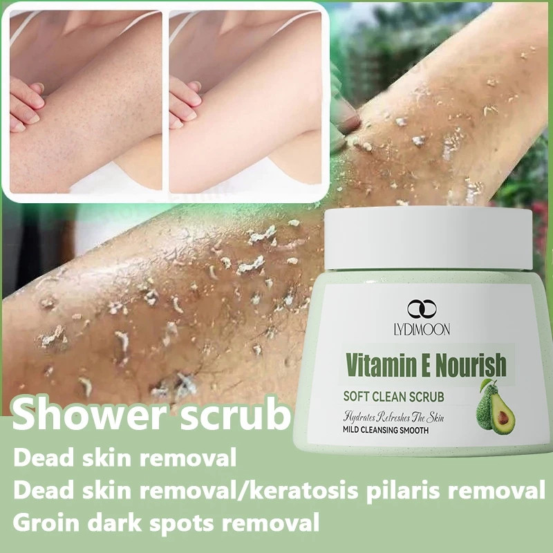 MY STOCK LYDIMOON Body Scrub 250g | รับประกันผิวเรียบเนียนขึ้น 7 วัน | น้ํายากําจัดหนังไก่