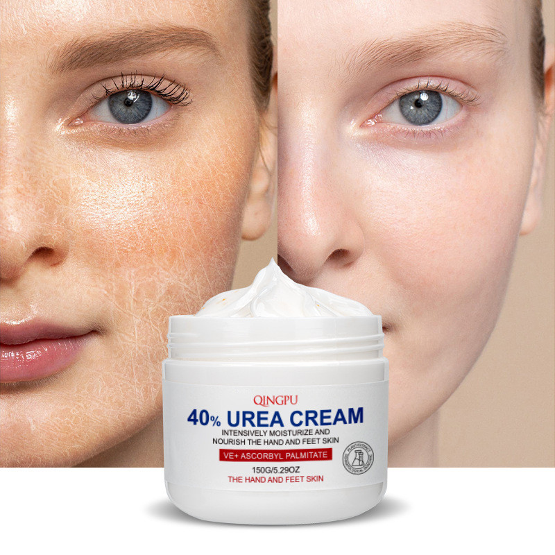 UREA CREAM 40% UREA CREAM 150g Hydrating Vitamin e Moisturizing CREAM Moisturizing Body Lotion บํารุ
