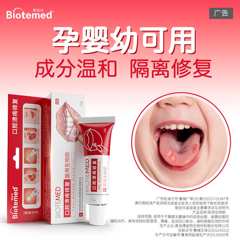 Boyite Oral Ulcer Gel Resurrection Mucosa Ulcer Oral Ulcer Burst บนลิ้น Foaming เด็กหญิงตั้งครรภ์