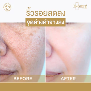 Smooth E 24K Gold Hydroboost Serum 4ML เซรั่มอันดับ 1 เซรั่มลดเลือนริ้วรอย จุดด่างดำ เห็ลผลใน 2 สัปดาห์ ผิวใสฉ่ำโกล์ว