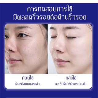 💕ของแท้อย่างเป็นทางการ💕【COD】เซรั่มลดเลือนเข้มข้นให้ความชุ่มชื้น/สารสกัดจากธรรมชาติ/เซรั่มลดเลือนริ้วรอยออร์แกนิก/ไม่มีสารเคมีอันตราย/ลดรอยตีนกา/ริ้วรอยแก้ม/ริ้วรอยหน้าผาก/เหมาะสำหรับทุกสภาพผิว/保湿浓缩抗皱精华液
