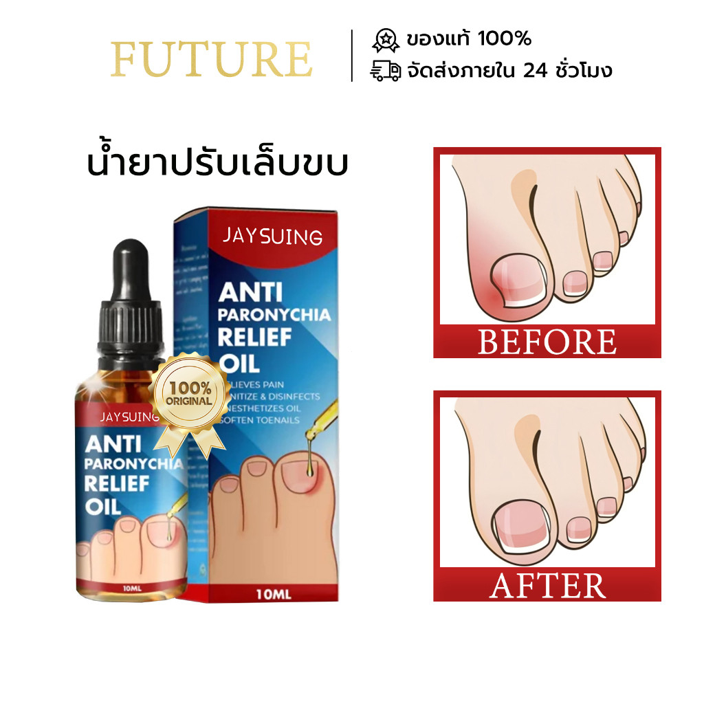 เจย์ซิง โซลูชั่นรักษาเล็บเท้าคุดรักษาเล็บเท้าคุดรักษาเล็บเท้าการติดเชื้อที่ขอบเล็บเล็บหักซ่อมแซมเล็บรักษาเล็บเชื้อรา