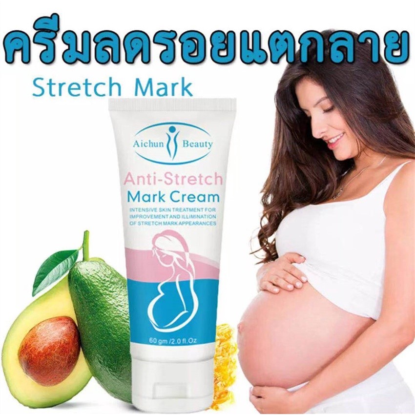 AICHUN ครีมลดรอยแตกลาย60กรัม