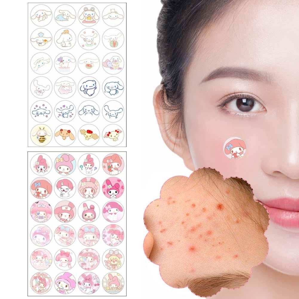 24pcs สิว Pimple Patch สติกเกอร์สิว Pimple Remover เครื่องมือ Blemish Spot Facial Mask Skin Care Sanrio การ์ตูนซ่อนสิว