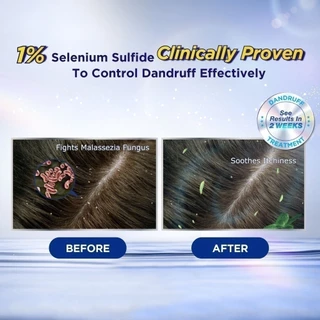 Selsun Blue Anti-Dandruff Shampoo 120/200ml เซลซั่น บลู แชมพูขจัดรังแค ดูแลปัญหาหนังศีรษะ