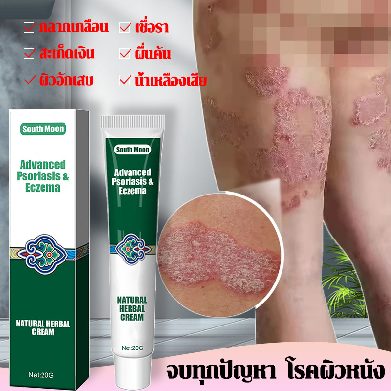 แก้คัน อบรรเทาอาการคันผิวหนัง ครีมเฉพาะที่ 20g สะเก็ดเงิน ครีมทาบรรเทาอาการคัน ครีมกลากเกลื้อน กลาก สังคัง ครีมบำรุงผิว