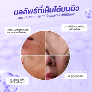 SEYOUL Collagen Jelly Mask มาสก์คอลลาเจน เจลลี่มาสก์เกาหลี ผิวชุ่มชื้น ใสเด้ง ฉ่ำน้ำ 1 กล่อง (5 ชิ้น)