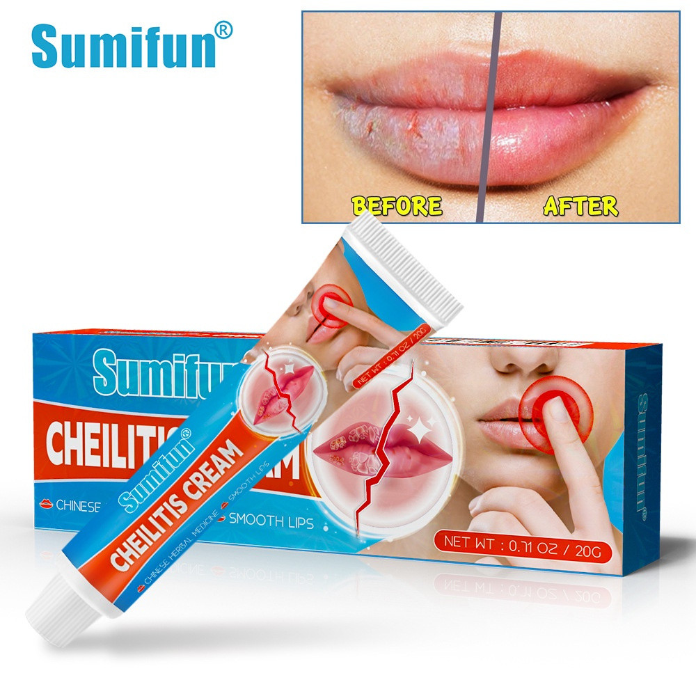 การเลือกร้านค้า Sumifun 20 g/box ครีมคีลูทิสผิวใช้ภายนอก K101056.27NN
