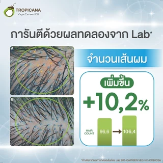 [เซ็ต] Tropicana | ทรอปิคานา แชมพู-ครีมนวดผมมะพร้าว สูตรลดผมขาดหลุดร่วง