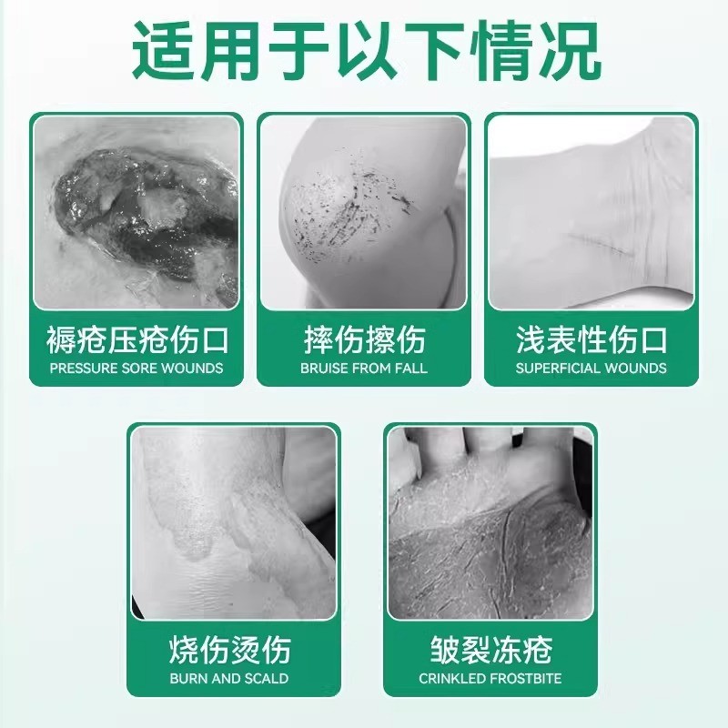 Toon Industry Anxin Brand Silver Ion Disinfection Gel 20g718