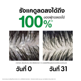 วิชี่ VICHY DERCOS ANTI-DANDRUFF SHAMPOO แชมพูสำหรับผู้ที่มีปัญหารังแคพร้อมป้องกันการกลับมาเป็นซ้ำ 390ml