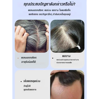 ของแท้💯วิกผมด้านบนกะโหลกสูงธรรมชาติ แฮร์พีช ปิดผมบาง เพิ่มผมหนา มีหน้าม้า ปิดหงอก แผ่นปิดบาง หงอก