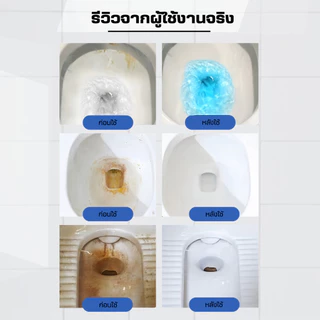 ก้อนดับกลิ่นชักโครก2IN1(สูตรอัพเกรดขจัดคราบx2เท่า) ก้อนฟ้าใส่ชักโครก ก้อนใส่ห้องน้ำ น้ำยาดับกลิ่นชักโครก ล้างห้องน้ำ