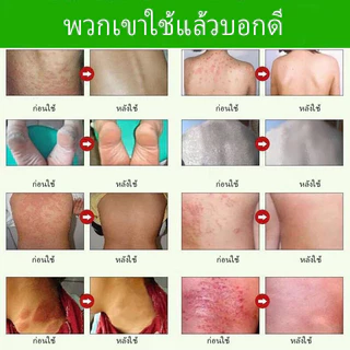 ของแท้! Creamถูกที่สุด! ครีมสมุนไพรธรรมชาติครีม15g บำรุงผิวหนัง จบทุกปัญหา
