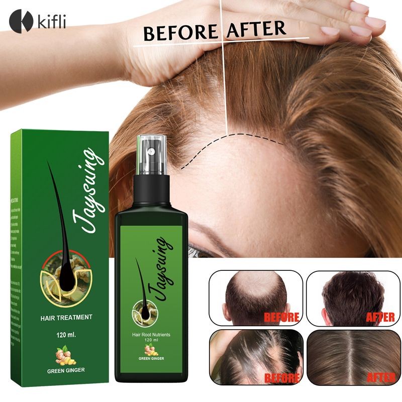 kifli.thDense Hair Spray Strong Hair Growth Spray Nourishing Hair Root Nutrient Solution-KI