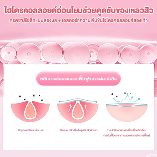 แผ่นซับสิว แผ่นสิว สําหรับติดตกแต่งสิว ดูดสิว สำหรับปกปิดจุดด่างใบหน้า การยึดเกาะที่แข็งแรง ไม่หลุดง่าย ลายการ์ตูน