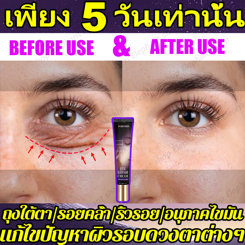 ครีมบํารุงรอบดวงตาเรตินอล เซรั่มบํารุงรอบดวงตา ลดความหมองคล้ํา ลดถุงใต้ตา ลดเลือนริ้วรอยรอบดวงตา ลบรอยคล้ําและถุงใต้ตา ฟื้นฟูผิวรอบดวงตา