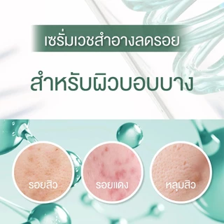Smooth E เซรั่มลดรอยแผลเป็นจากสิว Smooth E Acne Scar Serum 7g. ลดจุดด่างดำ ลดรอยดำ หลุมสิว แผลคีลอยด์ เห็นผลใน 2 สัปดาห์