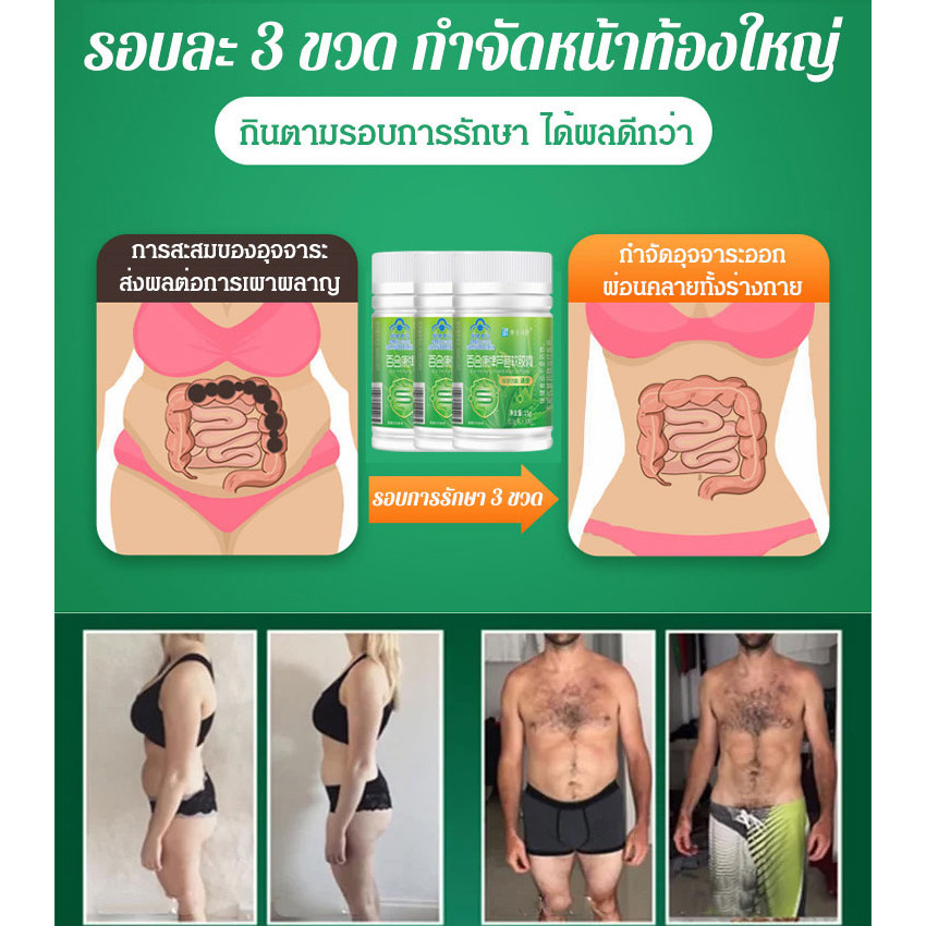 🔥Hot Sell🔥【ส่งเสริมการเคลื่อนไหวของลำไส้】 อโลเวร่า ซอฟท์เจล【促进肠蠕动】芦荟软胶囊/บรรเทาอาการท้องผูกได้อย่างมีประสิทธิภาพในระยะยาว/แคปซูลสลายไขมันและสลายไขมัน - รูปที่ 2