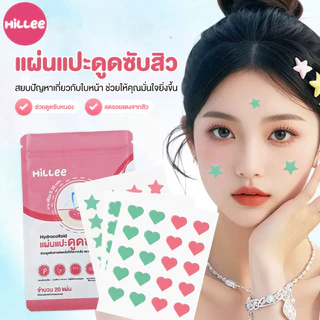 แผ่นซับสิว แผ่นสิว สําหรับติดตกแต่งสิว ดูดสิว สำหรับปกปิดจุดด่างใบหน้า การยึดเกาะที่แข็งแรง ไม่หลุดง่าย ลายการ์ตูน