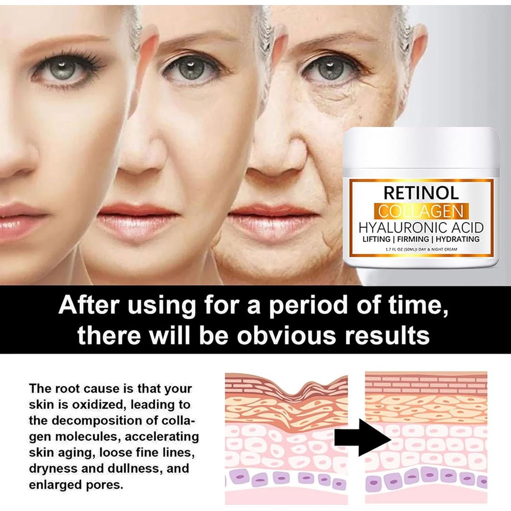 Retinol Face Cream 50g พร้อมวิตามินอี - ครีมคอลลาเจน - ต่อต้านริ้วรอย Skin Lightening Dark Spot Remo