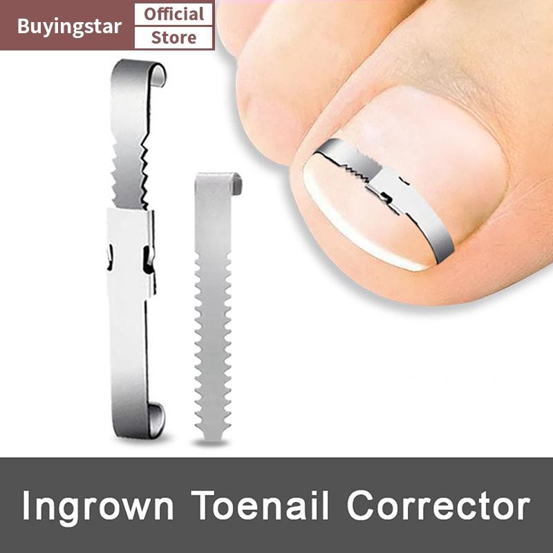 ZCX คุด Toenail Corrector เครื่องมือ Pedicure Recovered Toe Nail Treatment Foot Care Correction เครื่องมือ Care เท้า VO