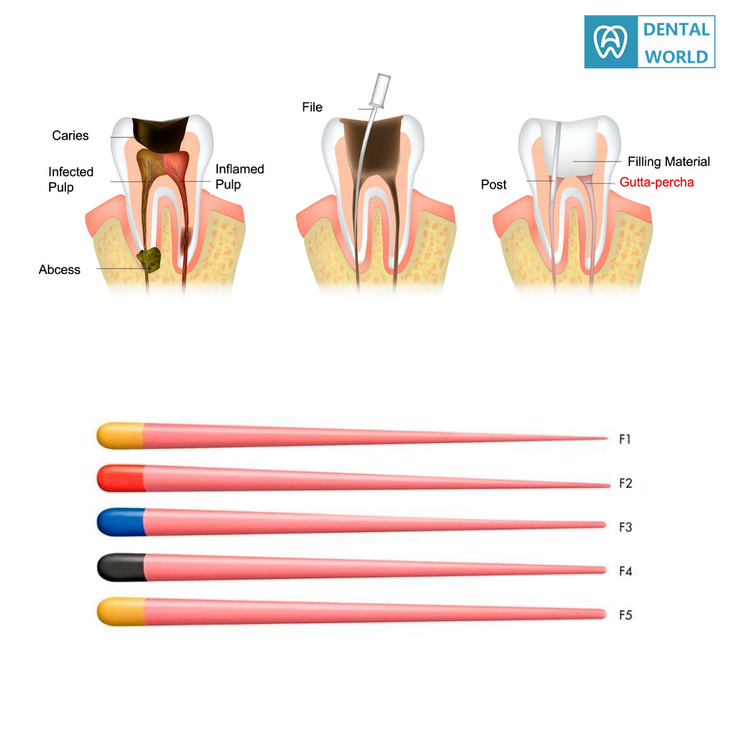 ทันตกรรมเฉพาะ Gutta Percha Points Endo Greater F1 F2 F3 F4 F5 F1-F3 - รูปที่ 2