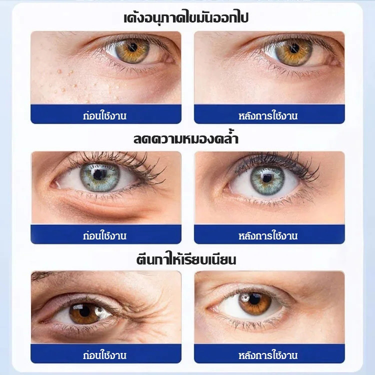 Firming Patch Fade Eye Bags มาส์กหน้าไมโคร - รูปที่ 3