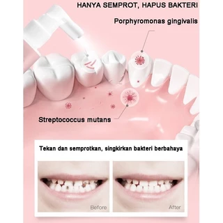 สเปรย์ป้องกันฟันผุ ปกป้องฟันของเด็ก เหมาะสำหรับเด็กอายุ 1-12 ปี Tooth Spray Children Baby Tooth Cleaning