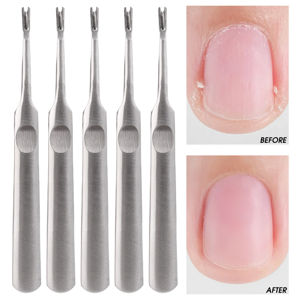 Nail Cuticle Pusher - เครื่องมือทําเล็บมือเล็บเท้า - เครื่องล้างเล็บ - ส้อมผิวที่ตายแล้วแคลลัส - เครื่องล้างหนังกําพร้าสแตนเลสมืออาชีพ