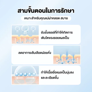 แผ่นปกปิดรอยแผลเป็น สติกเกอร์คอนซีลเลอร์ รักษารอยแผลเป็น กันน้ำและระบายอากาศได้ ฉีกและติดง่าย ส่วนผสมอ่อนโยนและปลอดภัย