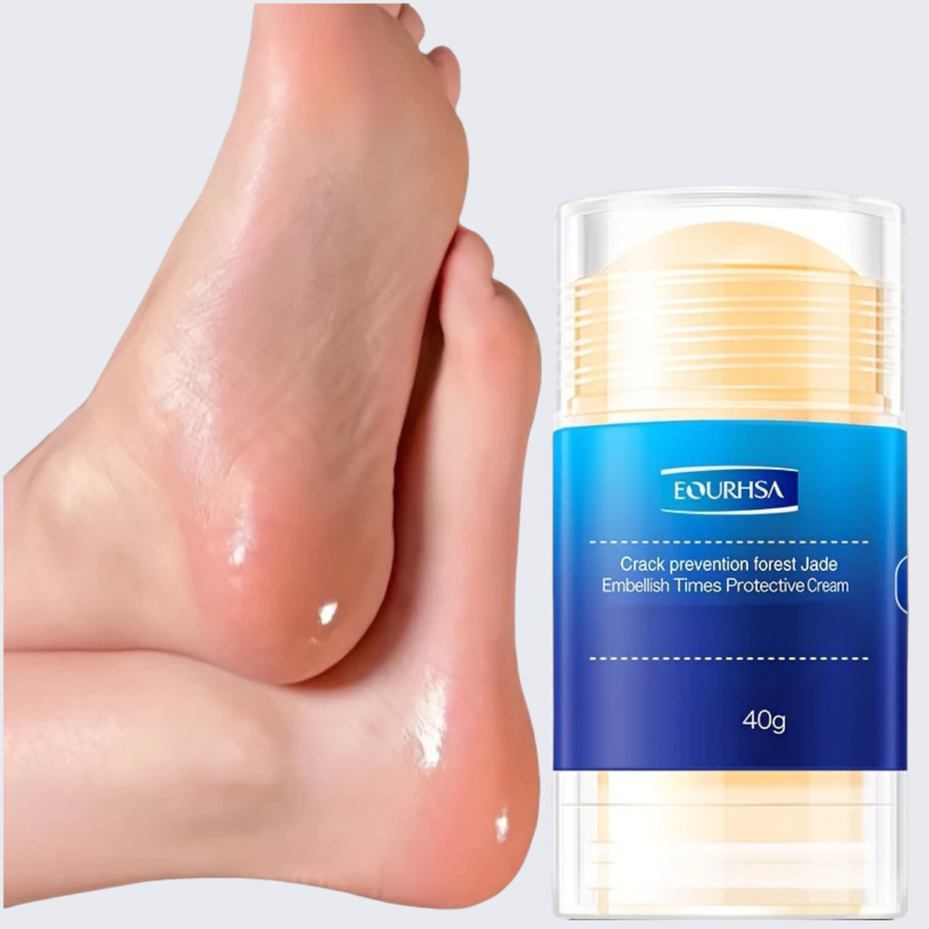 40g Remobing Dead Skin และแคลลัส Cracked Feet Cream Stick Repairing Cracked Feet Moisturizing Feet H