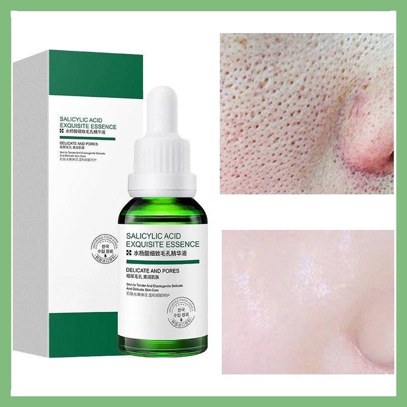 พร้อมสต็อกSalic Acid Pore Rinning Serum Moisturizing Nourishing Firming Whitening Anti-Aging Anti-Wrinkle Facial Skin Care U4TT