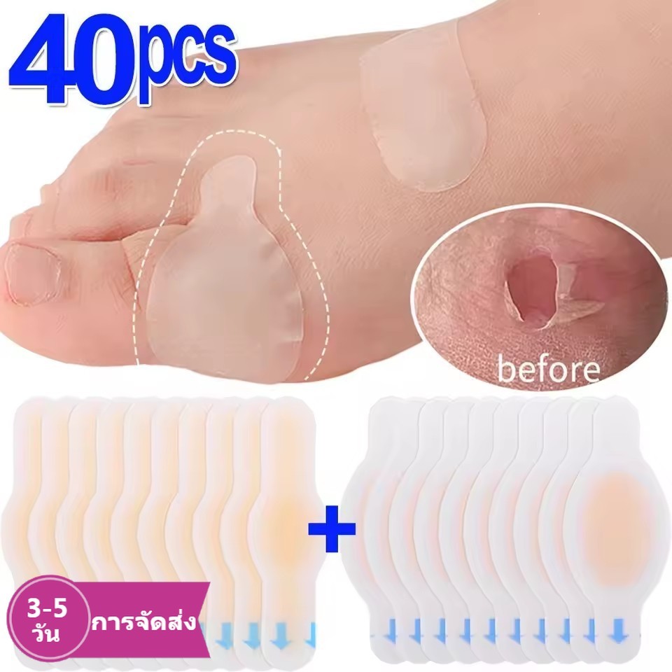 แพทช์ป้องกันแรงเสียดทานสำหรับรองเท้า แบบโปร่งใส ลดการเกิดแผล หลายขนาด 10/20/40 ชิ้น/แพ็ค (2*6ซม.-2.8*6.9ซม.) ส่งภายใน 3-5 วัน