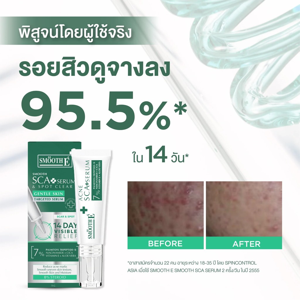 [แพ็ค 2] Smooth-E เซรั่มลดรอยแผลเป็น จากสิว จุดด่างดำ หลุมสิว แผลผ่าตัด ขนาด7กรัม สมูทอี Smooth E Acne Scar Serum - รูปที่ 6