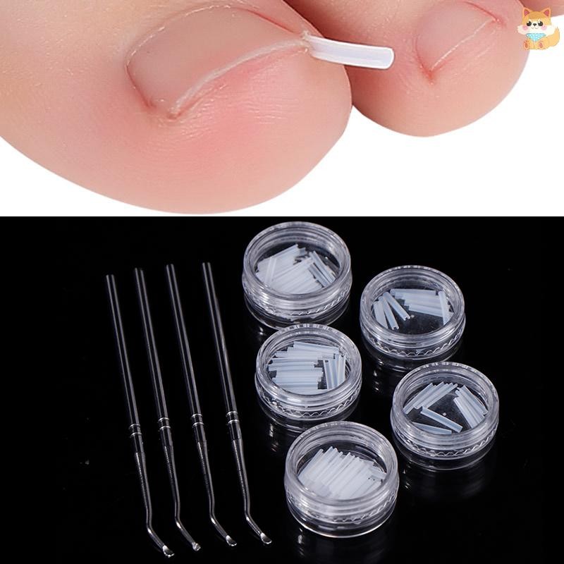 [VI] Toe Nail Care Hook คุด Double Ended คุด Toe Correction Lifter แฟ้มทําเล็บมือเล็บเท้าเล็บเท้าทําความสะอาดเครื่องมือดูแลเท้า TH
