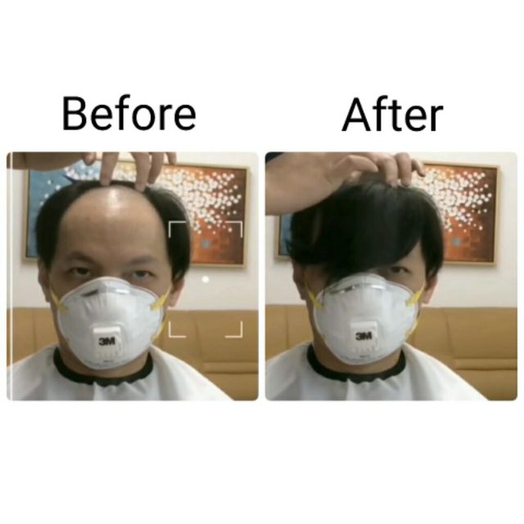 วิกติดกาวปิดหัวล้านพียู วิกติดกาวหน้าผากผู้ชาย ผมแท้100% รูปที่ 4