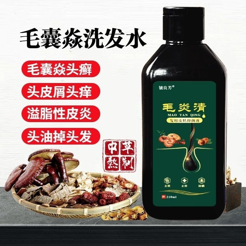 แชมพู แชมพูทําความสะอาดการอักเสบควบคุมความมันล้างไขมันป้องกันรังแค 210ml8ee